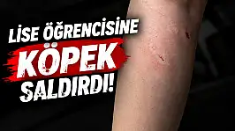 Lise Öğrencisine Köpek Saldırdı!