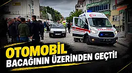 Otomobil Çarptı, Bacağının Üzerinden Geçti!