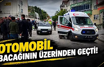 Otomobil Çarptı, Bacağının Üzerinden Geçti!