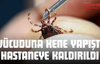 Vücuduna Kene Yapışan Genç Hastaneye Kaldırıldı