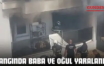 Yangında Baba Ve Oğul Yaralandı