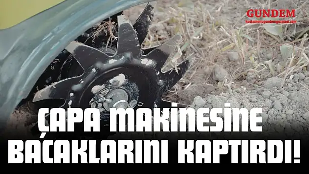 Çapa Makinesine Bacaklarını Kaptırdı!