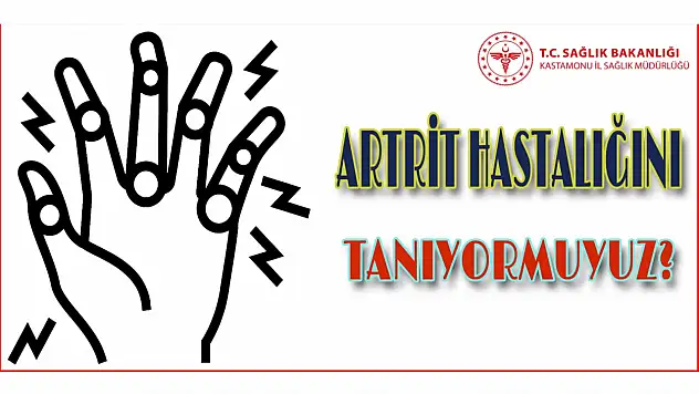 Kastamonu İl Sağlık'tan artrit bilgilendirmesi