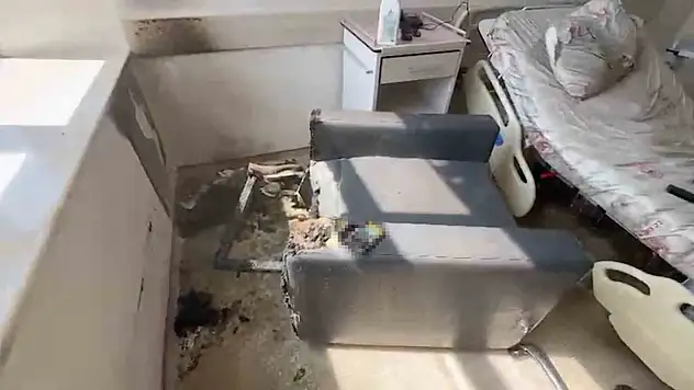 Sigara Hastaneyi Küle Çeviriyordu
