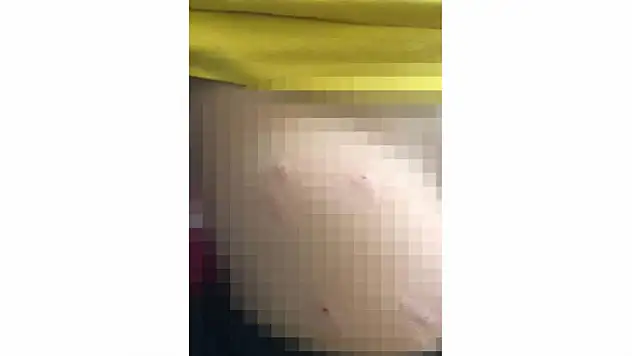 Sokak Köpeği 5 Yaşındaki Çocuğa Saldırdı