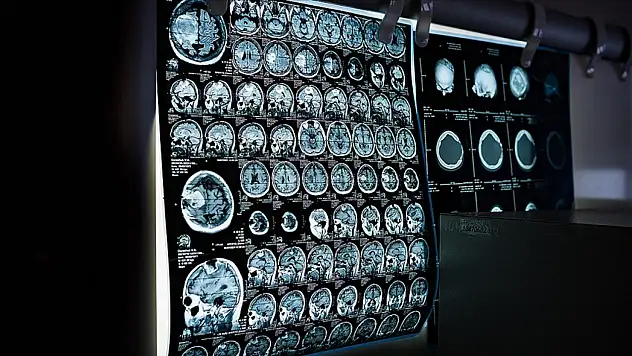 Türkiye'de Geçen Yıl 9,5 Milyon Kanser Taraması Yapıldı
