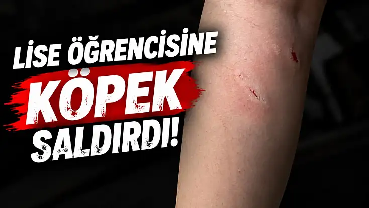 Lise Öğrencisine Köpek Saldırdı!