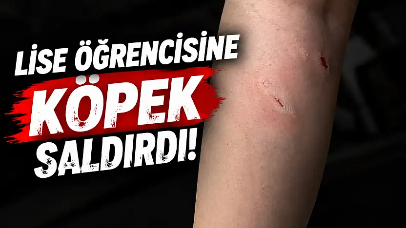 Lise Öğrencisine Köpek Saldırdı!