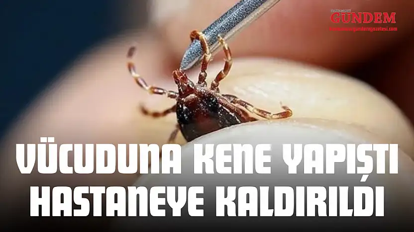 Vücuduna Kene Yapışan Genç Hastaneye Kaldırıldı
