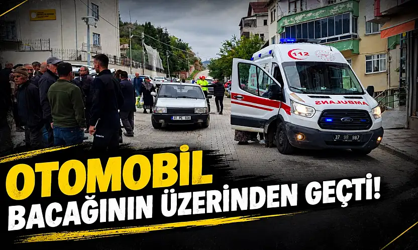 Otomobil Çarptı, Bacağının Üzerinden Geçti!