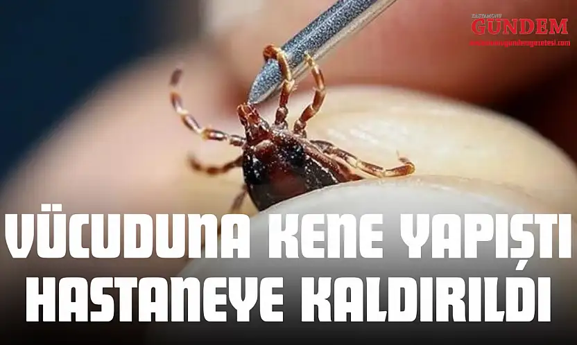 Vücuduna Kene Yapışan Genç Hastaneye Kaldırıldı