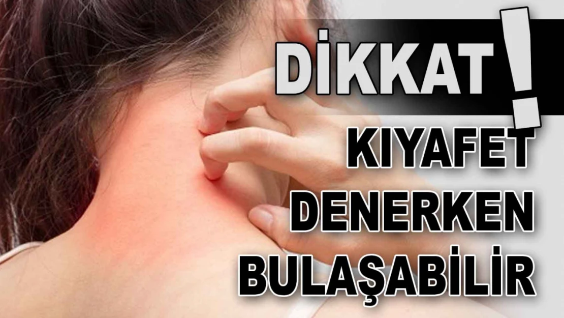 Cildiye Profesörü Uyardı: 'Kıyafet Denerken Bulaşabilir'