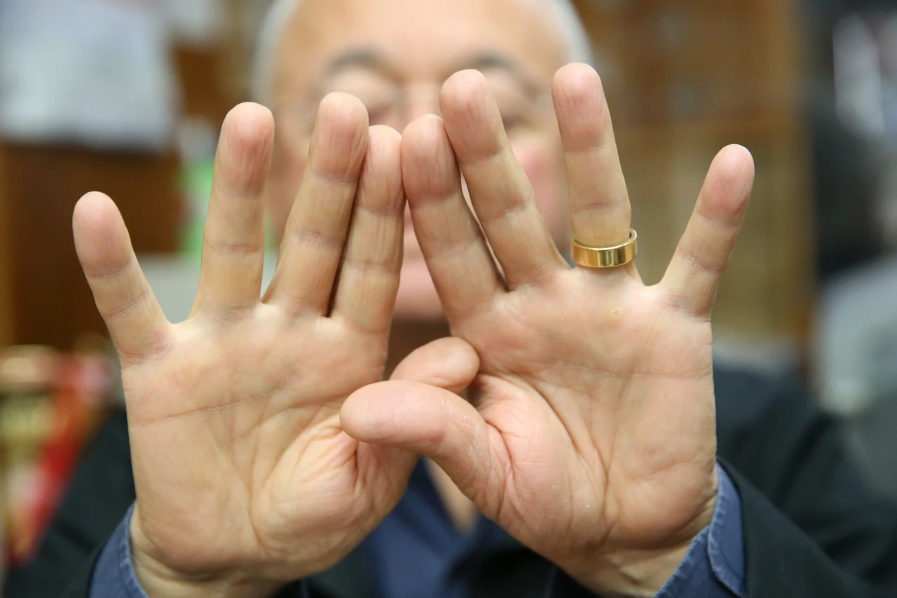 Mesleği, Parmak İzlerini Sildi