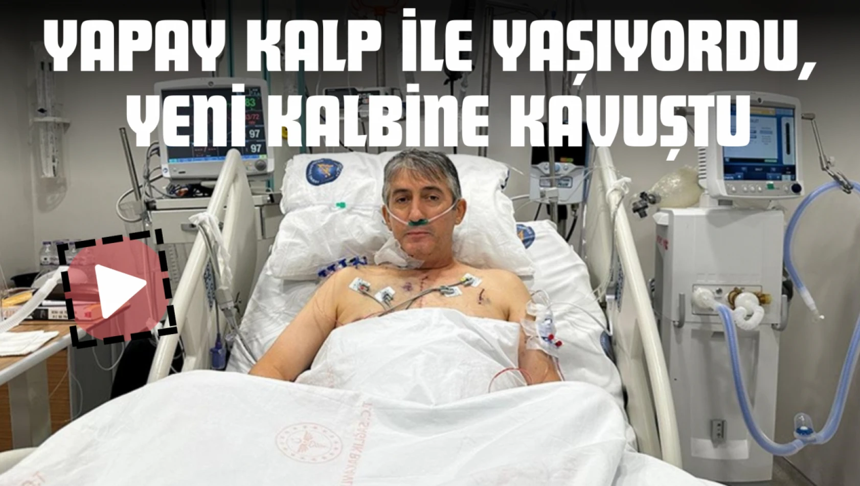 Yapay Kalp İle Yaşıyordu, Yeni Kalbine Kavuştu