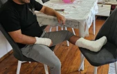 Köpek Saldırdı, Ayağı İki Yerden Kırıldı