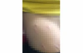 Sokak Köpeği 5 Yaşındaki Çocuğa Saldırdı