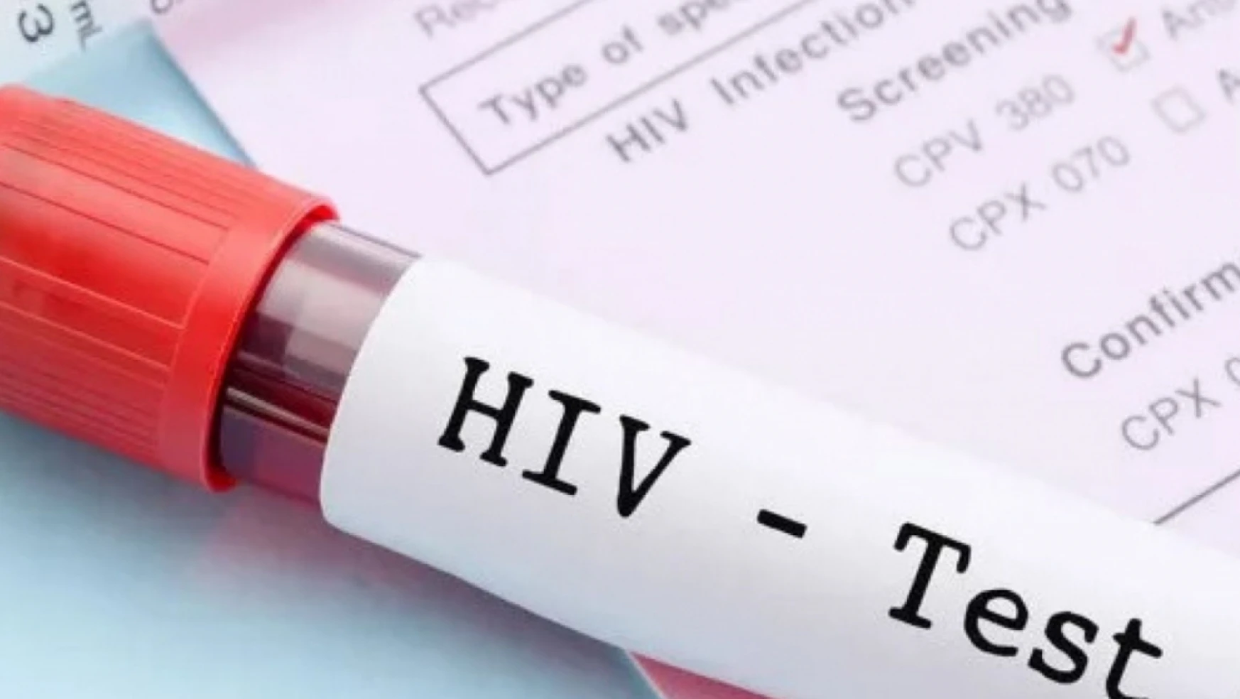 Karabük İl Sağlık Müdürlüğünden HIV İddialarına Yalanlama