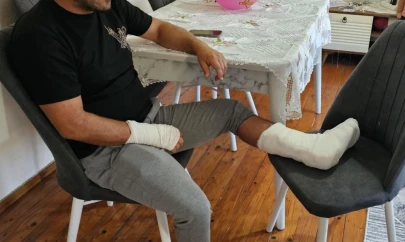 Köpek Saldırdı, Ayağı İki Yerden Kırıldı