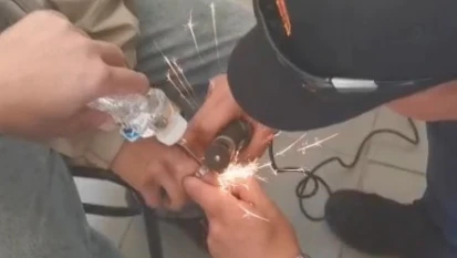 Parmağa Sıkışan Yüzük 2 Saatlik Çalışmayla Çıkarıldı
