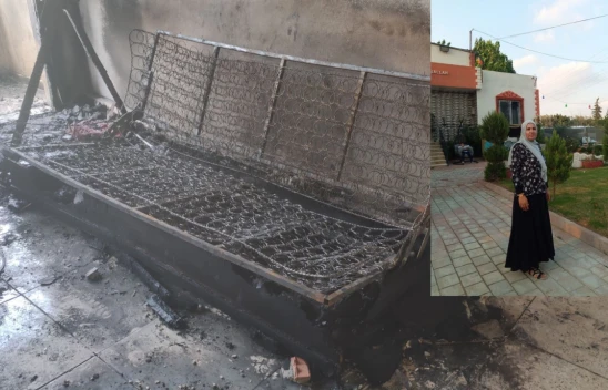 Boşandığı Eşi Tarafından Yakılan Kadın 36 Günlük Yaşam Savaşını Kaybetti