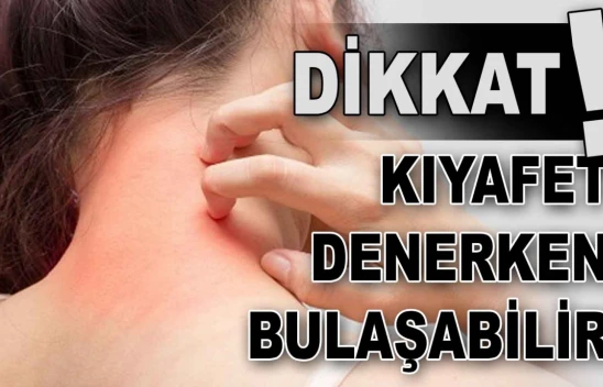 Cildiye Profesörü Uyardı: 'Kıyafet Denerken Bulaşabilir'