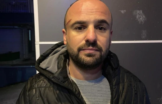 İşe Gitmek İçin Otomobiline Bindi, Dehşeti Yaşadı