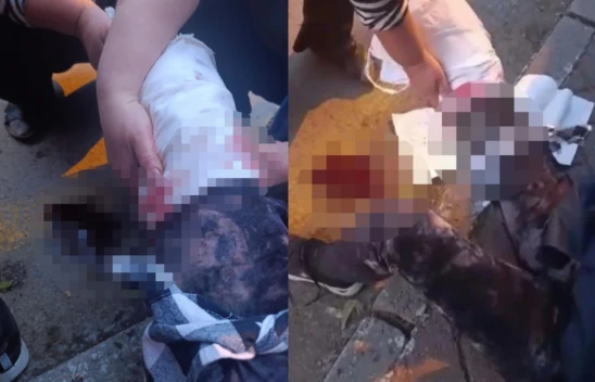 Kastamonulu Profesöre 9 Köpek Saldırdı