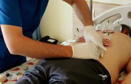 Uzmanlardan 'Hacamat' Uyarısı