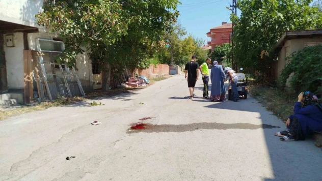 Çorum'da Elektrikli Motosiklet Kazası: 1 Yaralı