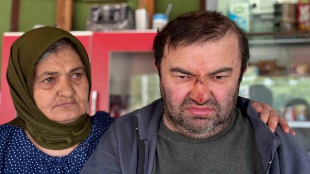 Yüzde 90 Engelli Vatandaş Darp Edildi