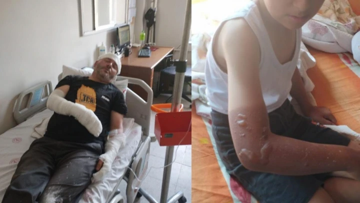 Yakılan çöpler patladı: 1'i çocuk 2 yaralı