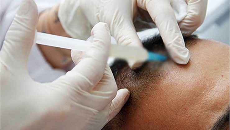 Anadolu Hastanesi'nde saç dökülmelerine son