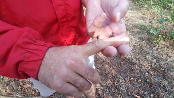 Ayının Saldırısına uğrayan Çiftçi O Anları Anlattı