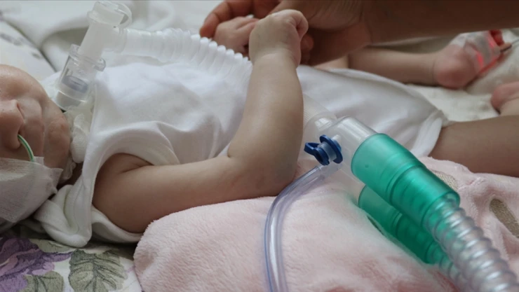 Bakan Işıkhan'dan SMA Hastalarına Müjde