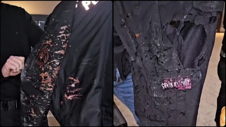 İçişleri Bakanı Yerlikaya 1 Polise Asit Atıldığını Bildirdi