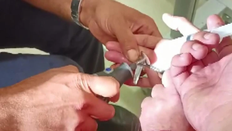 Parmağına sıkışan yüzükten itfaiye ekipleri kurtardı