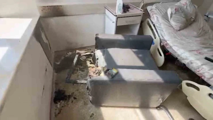 Sigara Hastaneyi Küle Çeviriyordu