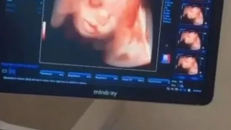 Sinop'a 4 Boyutlu Ultrason Cihazı