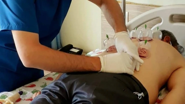 Uzmanlardan 'Hacamat' Uyarısı