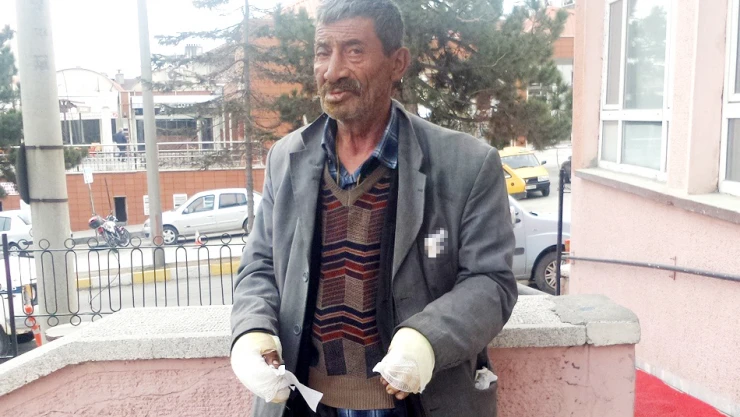 Yanan sobaya su yerine benzin döktü