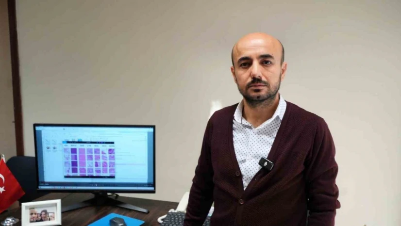 KBÜ'den Kolorektal Kanserin Erken Tanısına Yapay Zekâ Desteği